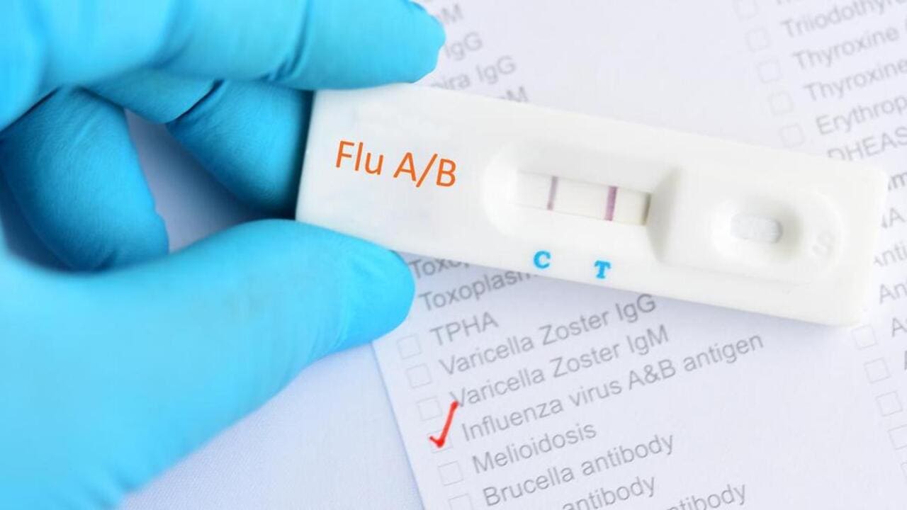 Penguatan Sistem Kesehatan atas Lonjakan Kasus Influenza A